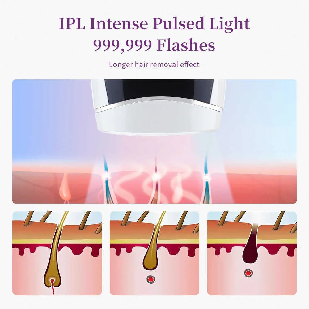 Permanent Hair Removal Machine